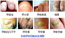 广州肤康皮肤病医院